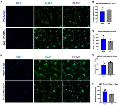 Human iPSC-derived neurons reveal NMDAR-independent dysfunction following HIV-associated insults
